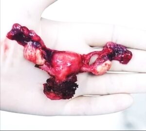 attachment-5da8d1c6a26b26307484f627